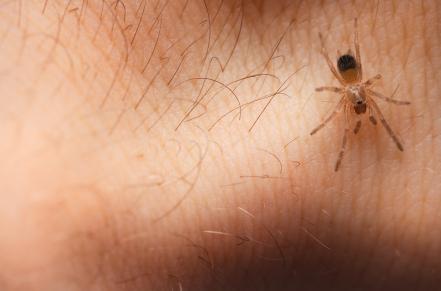 Spider on person's skin