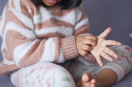 Child scratching their hands