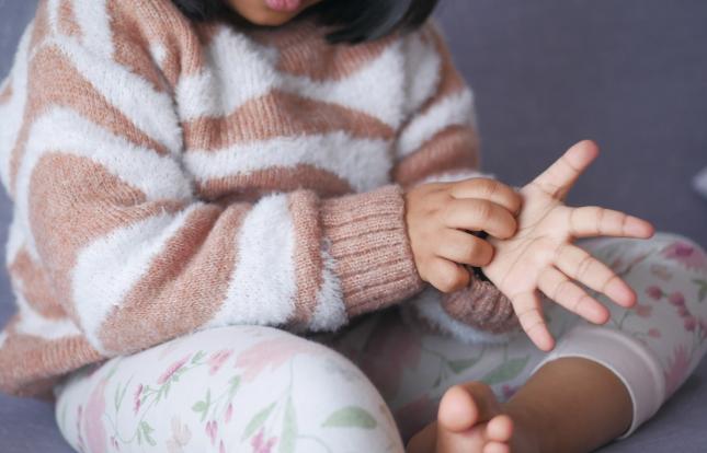 Child scratching their hands